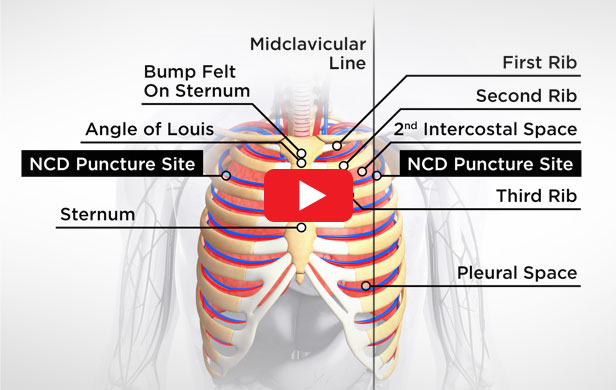 video-anatomy-diagram – U.S. LawShield Education Institute